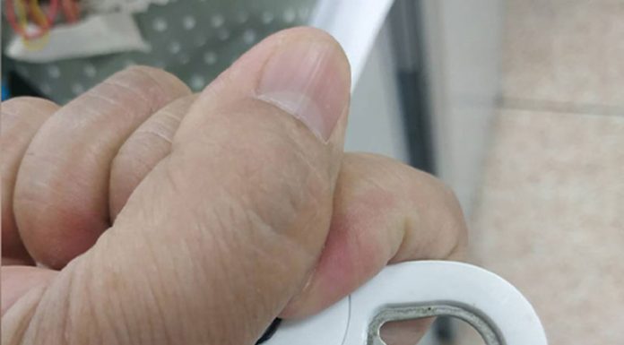 Doctors issue warning after Thai man gets penis stuck in bottle opener