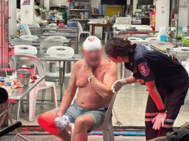 Scottish Man Injured in Pattaya Over Alleged Bar Girl Affair