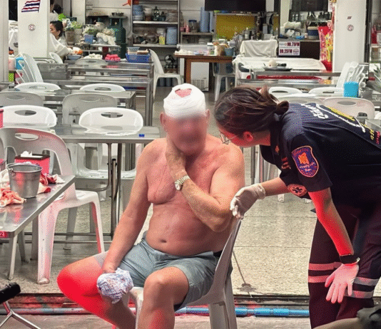 Scottish Man Injured in Pattaya Over Alleged Bar Girl Affair